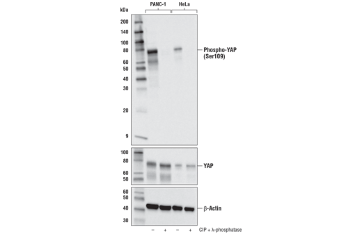 undefined Image 4: PhosphoPlus<sup>®</sup> YAP (Ser109) Antibody Duet