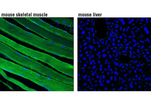 Immunofluorescence Image 1: PKM1 (D30G6) Rabbit Monoclonal Antibody (BSA and Azide Free)