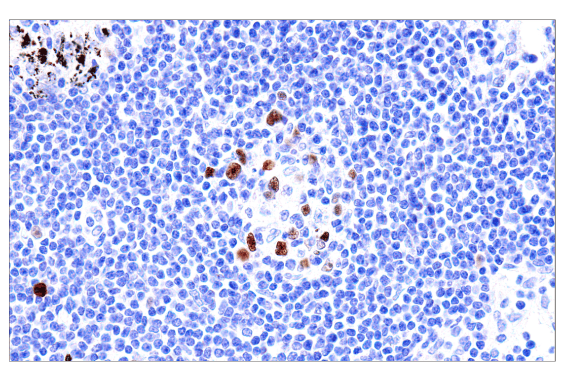 Immunohistochemistry Image 9: Phospho-NPM1 (Thr199) (E4C7S) Rabbit Monoclonal Antibody