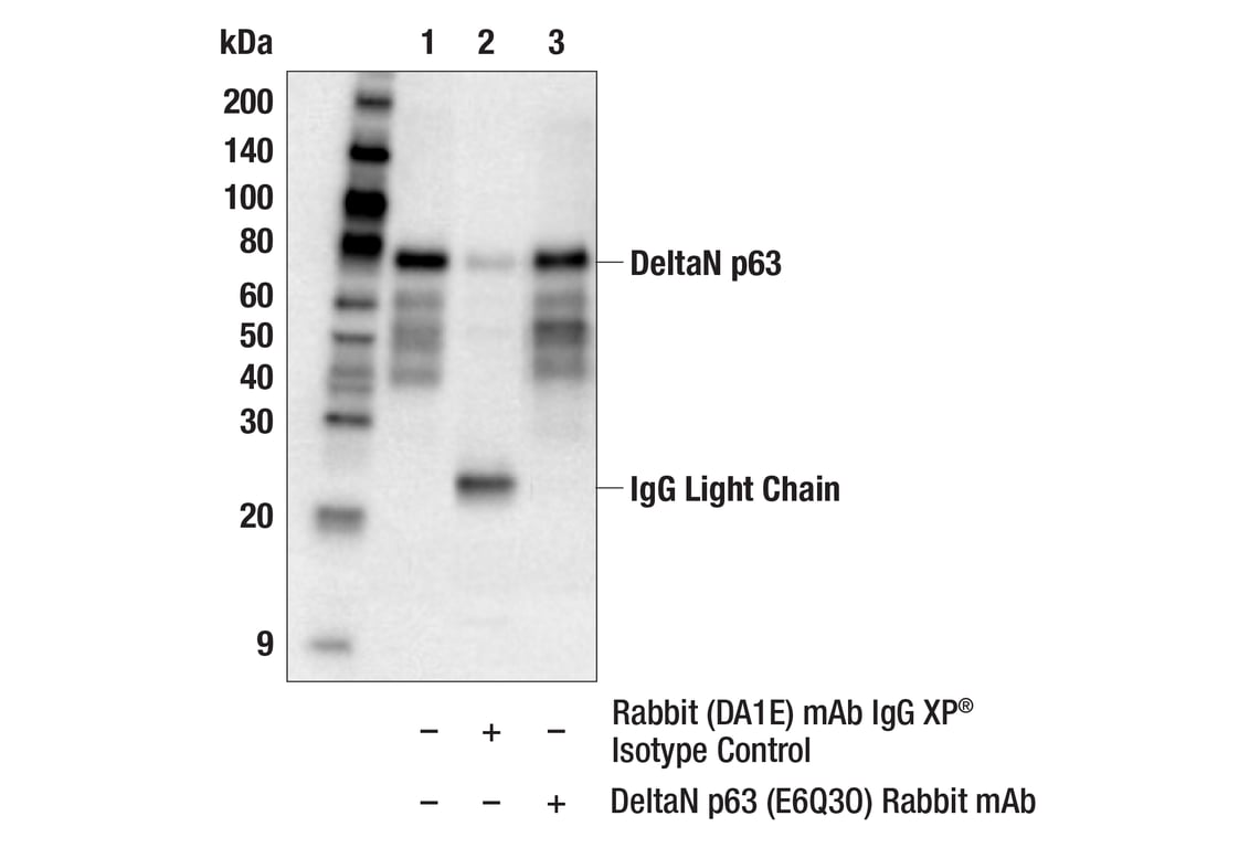 Immunoprecipitation Image 1: DeltaN p63 (E6Q3O) Rabbit Monoclonal Antibody