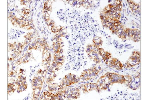Immunohistochemistry Image 2: Mcl-1 (D5V5L) Rabbit Monoclonal Antibody (BSA and Azide Free)
