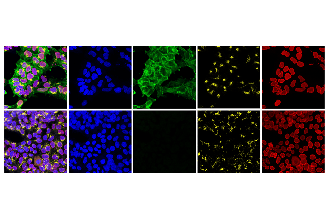 Immunofluorescence Image 2: Myc-Tag (E7F9B) Mouse Monoclonal Antibody