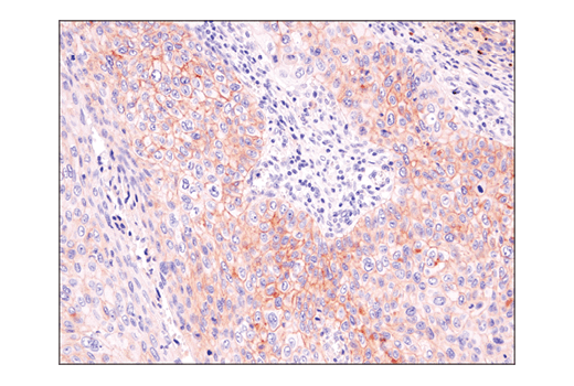 Immunohistochemistry Image 4: ASCT2 (D7C12) Rabbit Monoclonal Antibody