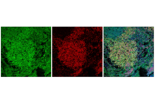 undefined Image 47: Phospho-Tau (Ser214/T217) Signaling Antibody Sampler Kit