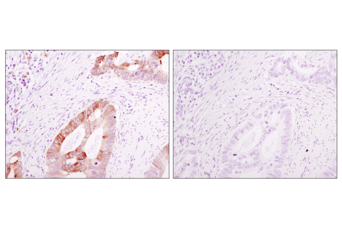 Immunohistochemistry Image 1: Rabbit (DA1E) Monoclonal Antibody IgG Isotype Control