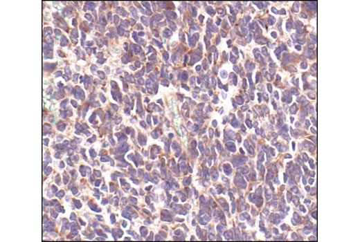 Immunohistochemistry Image 1: Neurofilament-L (DA2) Mouse Monoclonal Antibody (BSA and Azide Free)