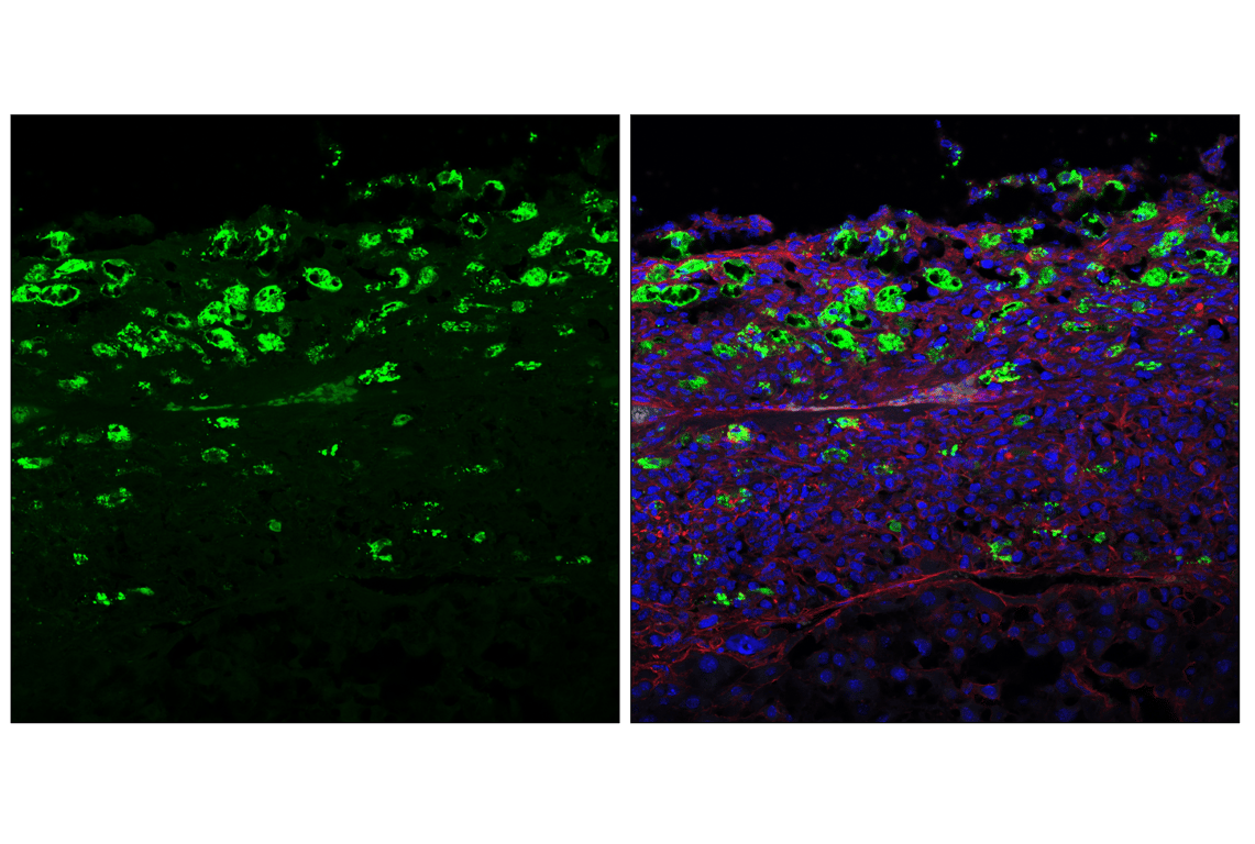 Immunofluorescence Image 1: Granzyme F (E2U7L) Rabbit Monoclonal Antibody (BSA and Azide Free)