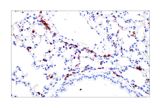 Immunohistochemistry Image 4: Integrin beta2 (E9O7W) Rabbit Monoclonal Antibody