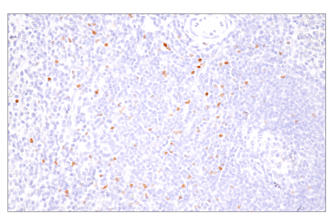 Immunohistochemistry Image 3: FoxP3 (D2W8E<sup>™</sup>) Rabbit mAb