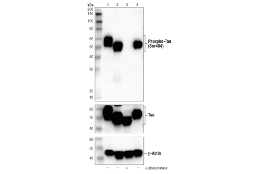 Western Blotting Image 2: Phospho-Tau (Ser404) (D2Z4G) Rabbit Monoclonal Antibody (IHC/IF Formulated)