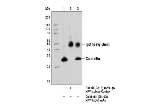 Immunoprecipitation Image 1: Calbindin (D1I4Q) Rabbit Monoclonal Antibody