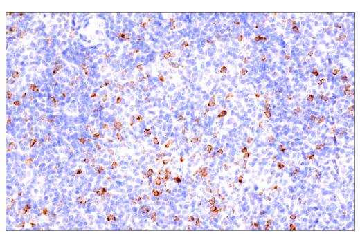 Immunohistochemistry Image 1: CTLA-4 (E2V1Z) Rabbit Monoclonal Antibody (BSA and Azide Free)