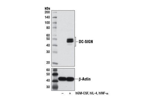 Western Blotting Image 2: DC-SIGN (D7F5C) Rabbit Monoclonal Antibody