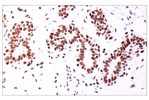 Immunohistochemistry Image 1: PBRM1/BAF180 (D4L9X) Rabbit Monoclonal Antibody