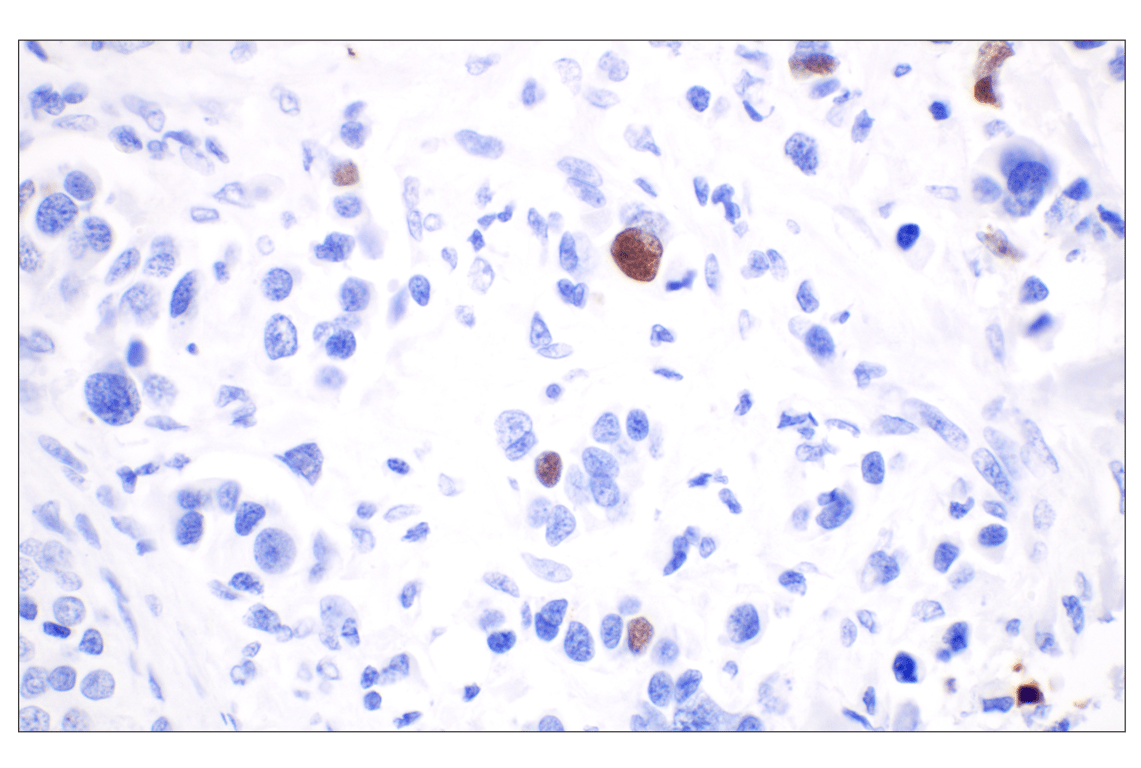 undefined Image 5: PhosphoPlus<sup>®</sup> DNA-PKcs (Ser2056) Antibody Duet