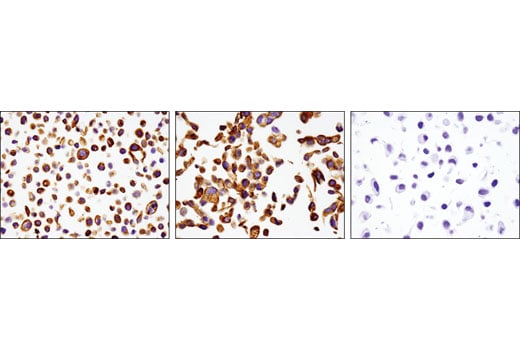 Immunohistochemistry Image 2: Keratin 17/19 (D4G2) Rabbit Monoclonal Antibody