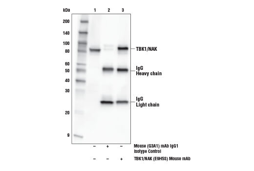 Immunoprecipitation Image 1: TBK1/NAK (E9H5S) Mouse Monoclonal Antibody