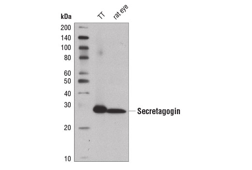 Western Blotting Image 1: Secretagogin (D4V1Y) XP<sup>®</sup> Rabbit mAb