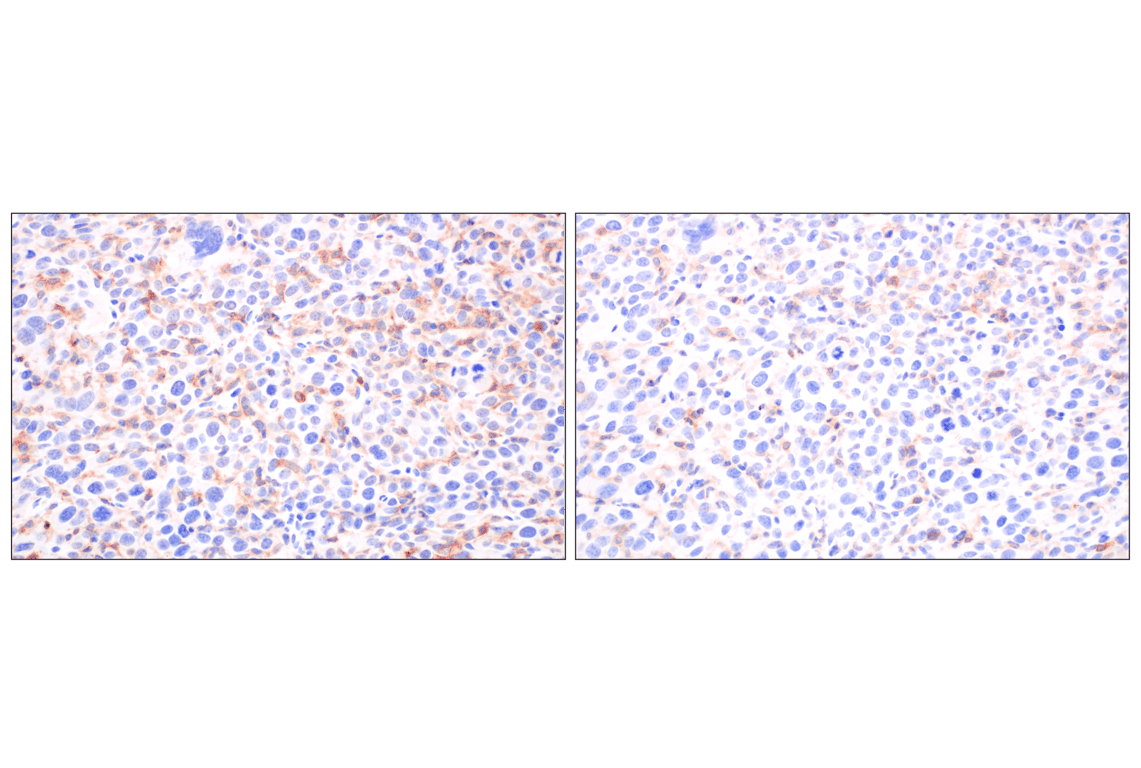 Immunohistochemistry Image 8: DAP12 (F1Q2P) Rabbit Monoclonal Antibody