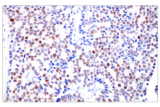 Immunohistochemistry Image 1: C/EBP beta (E2K1U) Rabbit Monoclonal Antibody (BSA and Azide Free)