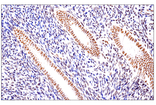 Immunohistochemistry Image 5: SETD2 (E4W8Q) Rabbit Monoclonal Antibody (IHC Formulated)