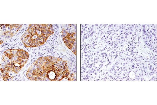 Immunohistochemistry Image 3: Keratin 17/19 (D4G2) Rabbit Monoclonal Antibody (BSA and Azide Free)