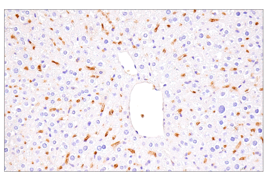 undefined Image 37: Genetics of Parkinson's Disease: Lysosomal Dysfunction Antibody Sampler Kit