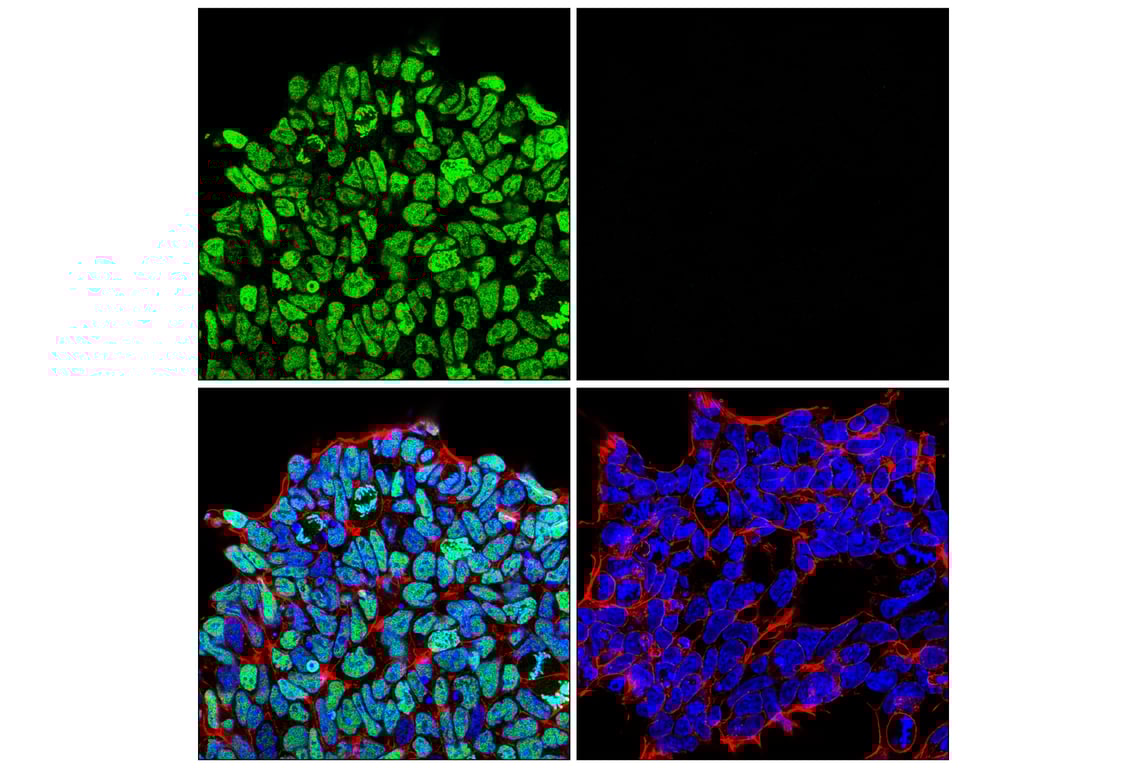 Immunofluorescence Image 1: Histone H3 (K36M Mutant Specific) (E8N1L) Rabbit Monoclonal Antibody