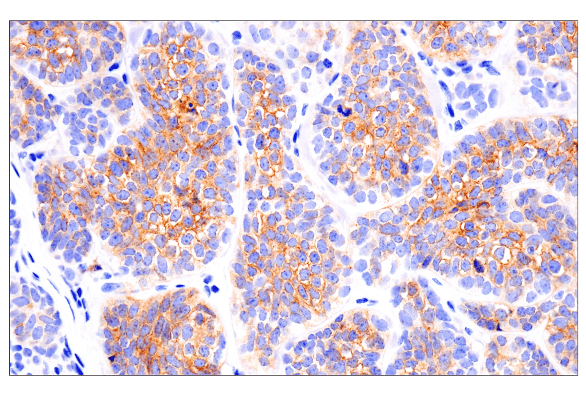 Immunohistochemistry Image 3: FGF Receptor 2 (D4L2V) Rabbit Monoclonal Antibody (BSA and Azide Free)