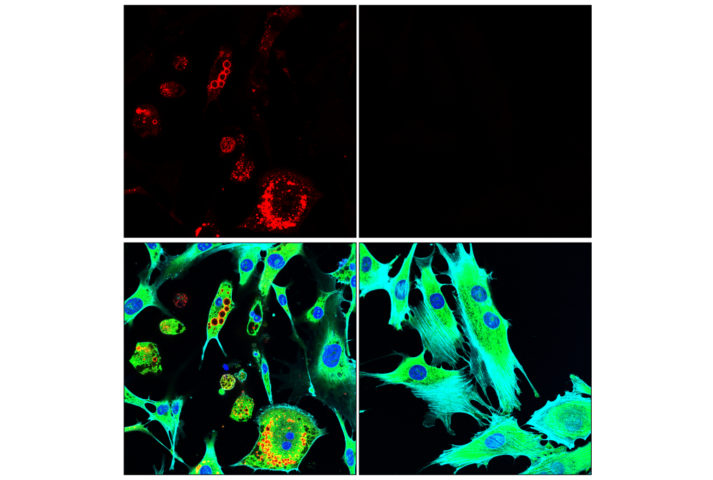 Immunofluorescence Image 1: Perilipin-1 (D1D8) Rabbit Monoclonal Antibody (Alexa Fluor<sup>®</sup> 647 Conjugate)