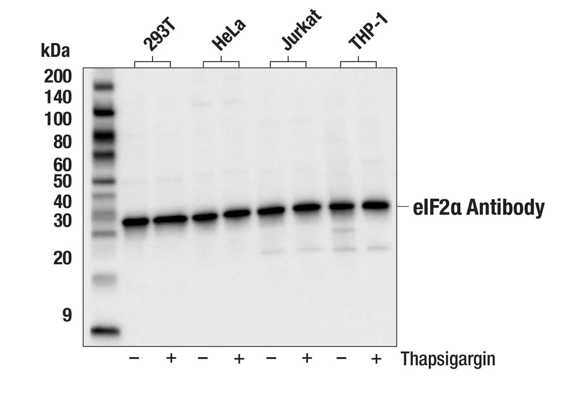 Western Blotting Image 2: eIF2 alpha Antibody
