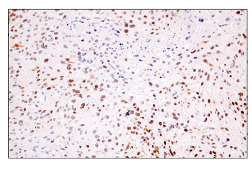 Immunohistochemistry Image 1: p14 ARF (E3X6D) Rabbit Monoclonal Antibody