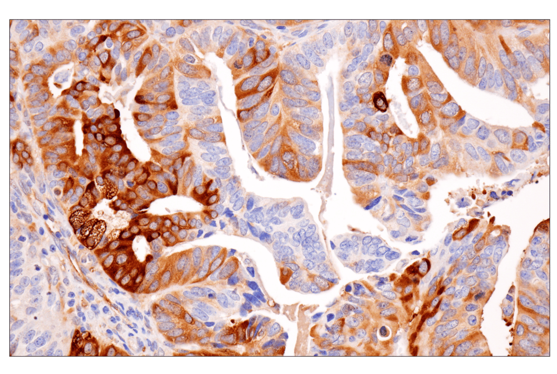 Immunohistochemistry Image 1: HSP27 (G31) Mouse Monoclonal Antibody (BSA and Azide Free)