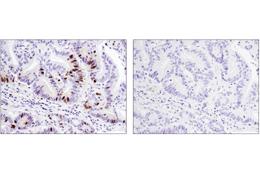Immunohistochemistry Image 4: FoxM1 (D3F2B) Rabbit Monoclonal Antibody