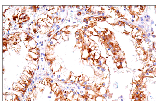 Immunohistochemistry Image 3: Cox2 (D5H5) Rabbit Monoclonal Antibody (BSA and Azide Free)
