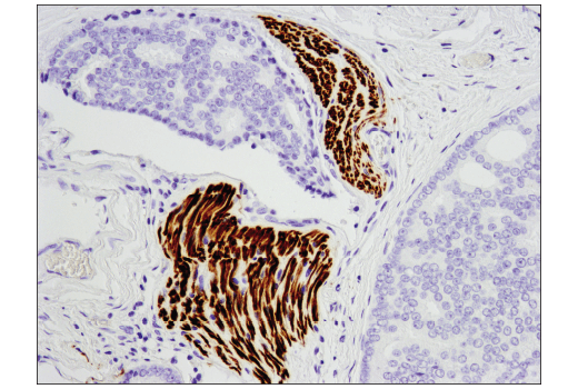 Immunohistochemistry Image 2: NCAM-L1 (D5D3K) Rabbit Monoclonal Antibody (BSA and Azide Free)