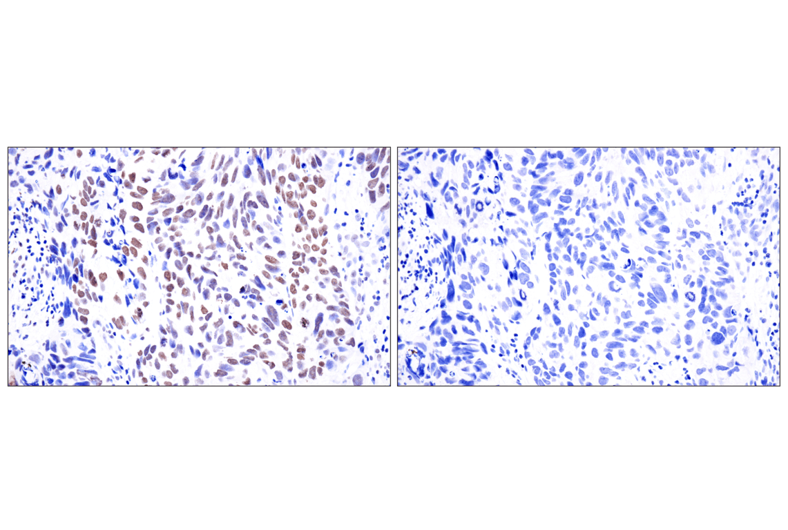 Immunohistochemistry Image 8: Acetyl-Histone H4 (Lys16) (E2B8W) Rabbit Monoclonal Antibody (BSA and Azide Free)