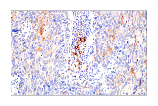 Immunohistochemistry Image 2: SignalStain<sup>®</sup> Boost IHC Detection Reagent (HRP, Rat)