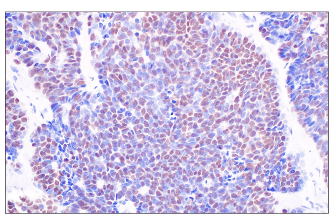 Immunohistochemistry Image 3: Sox10 (E2V9N) Rabbit Monoclonal Antibody