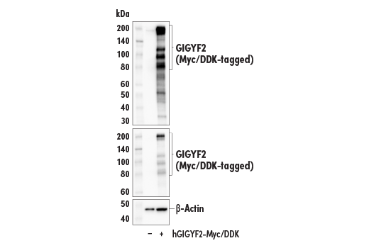 Western Blotting Image 4: GIGYF2 (E7F7I) Rabbit Monoclonal Antibody