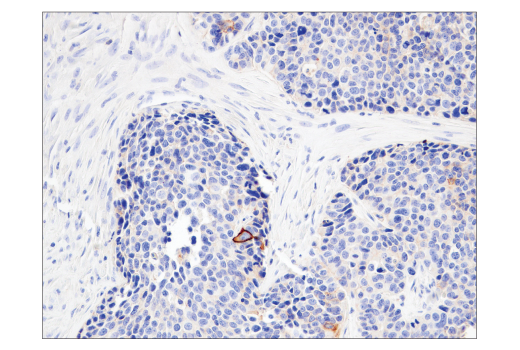 Immunohistochemistry Image 2: CD47 (D3O7P) Rabbit Monoclonal Antibody (BSA and Azide Free)