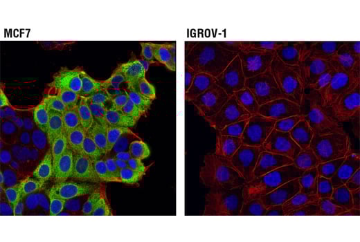 Immunofluorescence Image 1: AGR2 (D9V2F) Rabbit Monoclonal Antibody