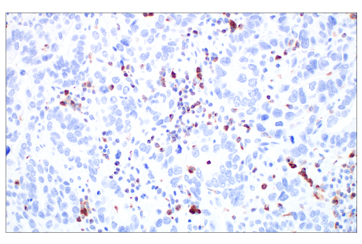 Immunohistochemistry Image 3: Glut3 (E7M7V) Rabbit Monoclonal Antibody