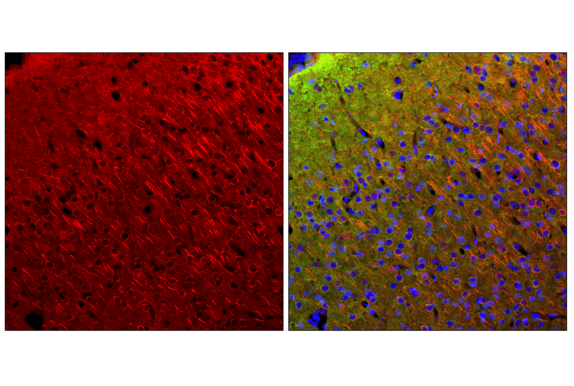β3-Tubulin (E9F3E) Mouse mAb (Alexa Fluor® 647 Conjugate