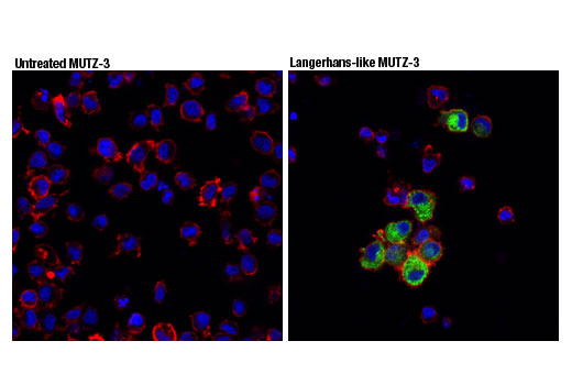 Immunofluorescence Image 1: Langerin (D9H7R) Rabbit Monoclonal Antibody (BSA and Azide Free)