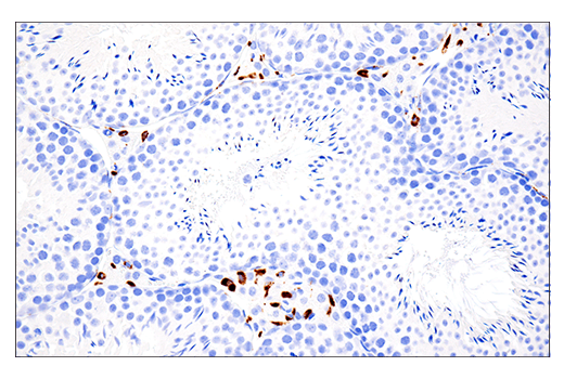 Immunohistochemistry Image 4: CD68 (E3O7V) Rabbit Monoclonal Antibody