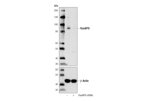 Western Blotting Image 2: RanBP9 (D8M8D) Rabbit Monoclonal Antibody