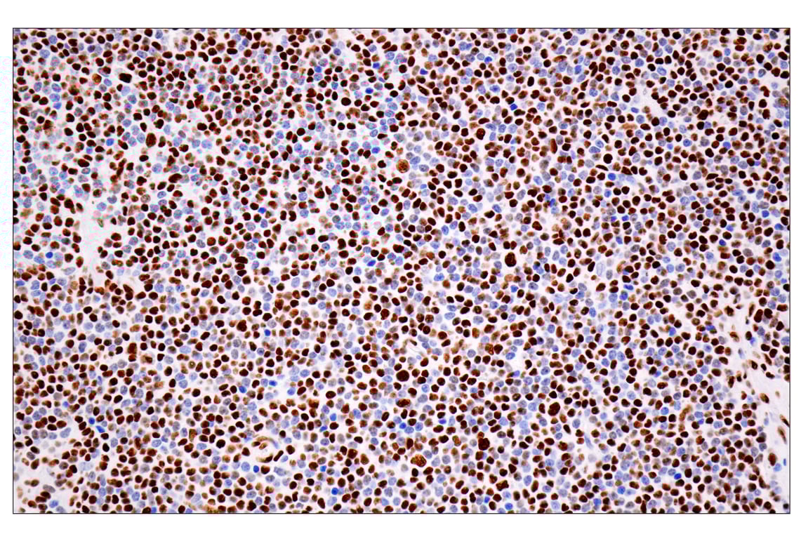 Immunohistochemistry Image 3: ILF3 (E5H6F) Rabbit Monoclonal Antibody