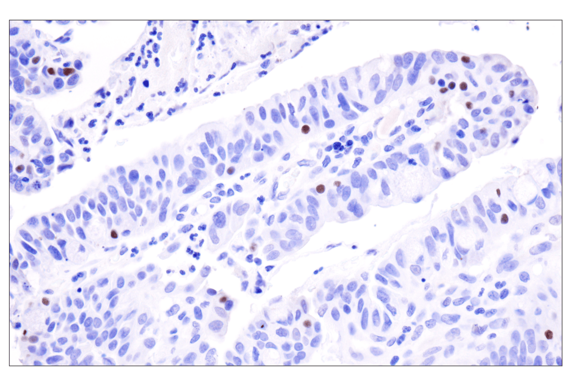 Immunohistochemistry Image 3: INSM1 (BLR272L) Rabbit Monoclonal Antibody