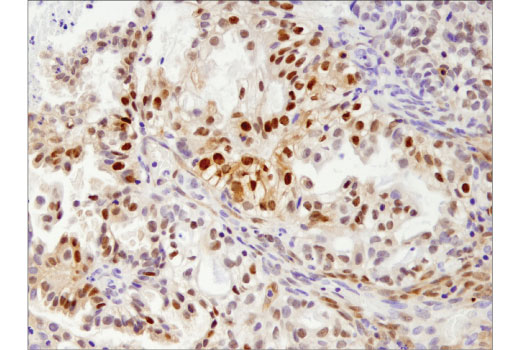 Immunohistochemistry Image 3: FoxO1 (D8T1S) Mouse Monoclonal Antibody